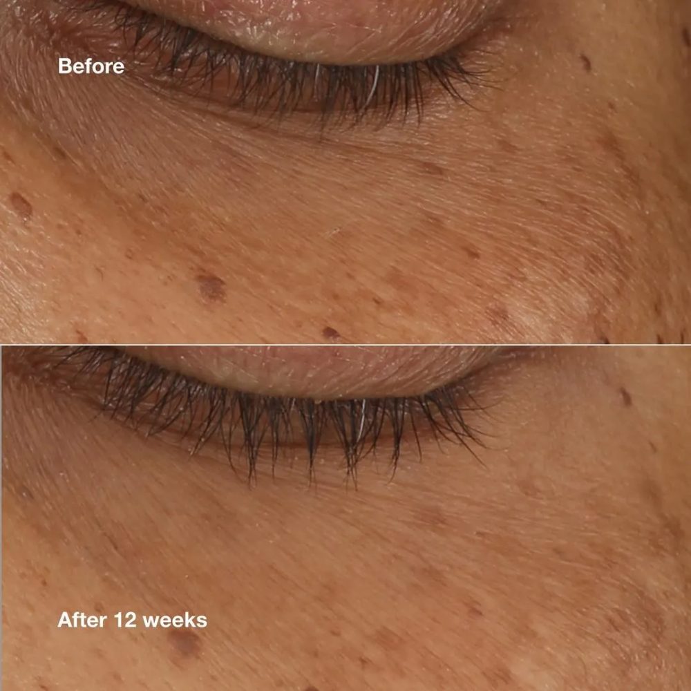 Clinique All About Eyes™ Brightening Serum Concentrate
