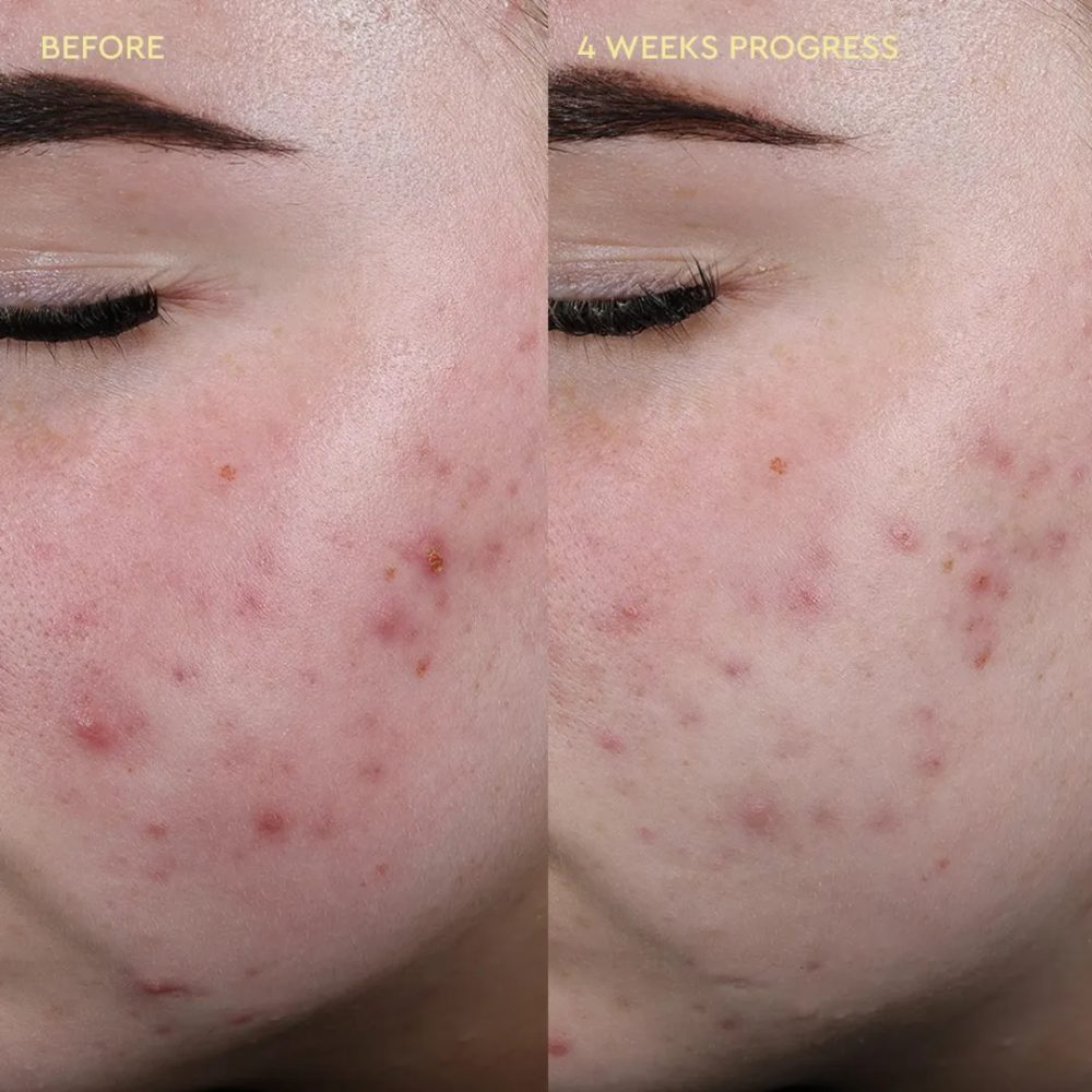 BYOMA Blemish Soothing Toner