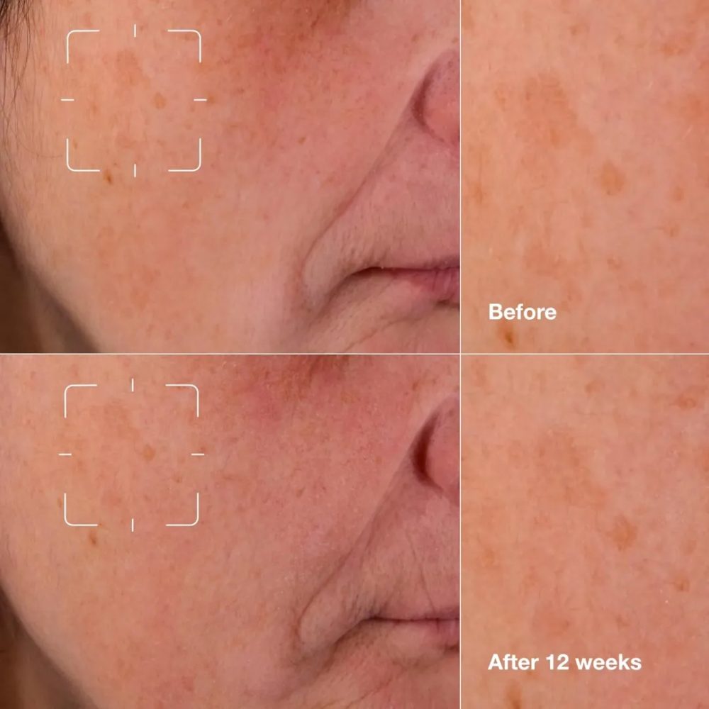 Clinique Even Better Clinical™ Dark Spot Clearing Serum